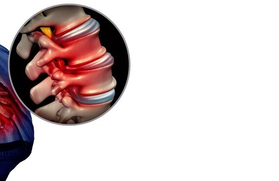 脊柱管狭窄症｜痛み治療｜ハリ治療｜お試し3回4400円｜